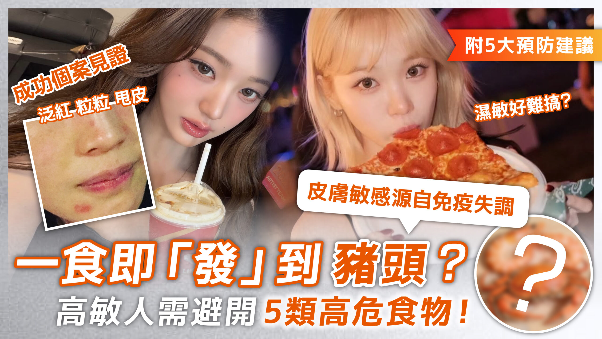 5招抗敏調理 改善紅腫痕癢